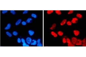 Immunofluorescence analysis of 293T cells using DiMethyl-Histone H3-K27 Polyclonal Antibody (Histone 3 antibody  (2meLys27))