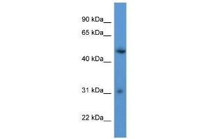WB Suggested Anti-ROPN1L Antibody Titration: 0. (ROPN1L antibody  (C-Term))