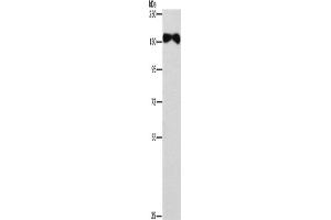 Western Blotting (WB) image for anti-Ellis Van Creveld Syndrome 2 (EVC2) antibody (ABIN2433002) (EVC2 antibody)