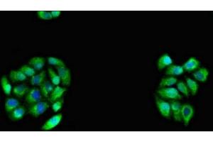 Immunofluorescent analysis of PC-3 cells using ABIN7146203 at dilution of 1:100 and Alexa Fluor 488-congugated AffiniPure Goat Anti-Rabbit IgG(H+L) (OB Cadherin antibody  (AA 637-796))