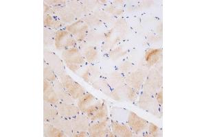 Immunohistochemical analysis of (ABIN656123 and ABIN2845462) on paraffin-embedded human skeletal muscle tissue was performed on the Leica®BOND RXm.