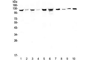Western blot testing of human 1) HeLa, 2) placenta, 3) COLO-320, 4) HepG2, 5) SGC-7901, 6) Jurkat, 7) rat stomach, 8) mouse skeletal muscle, 9) mouse stomach and 10) mouse brain lysate with IDE antibody at 0. (IDE antibody)