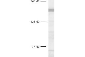 dilution: 1 : 1000, sample: rat brain homogenate (CASKIN1 antibody  (AA 1416-1430))