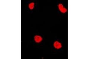 Immunofluorescent analysis of RAD54L2 staining in MCF7 cells. (ARIP4 antibody)