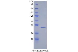 SDS-PAGE analysis of Human aZGP1 Protein. (AZGP1 Protein)