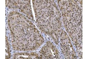 IHC analysis of CTBP2 using anti-CTBP2 antibody (ABIN7601326). (CTBP2 antibody  (AA 321-445))