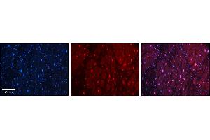 Immunohistochemistry (IHC) image for anti-Homeodomain Interacting Protein Kinase 2 (HIPK2) (Middle Region) antibody (ABIN2779735)