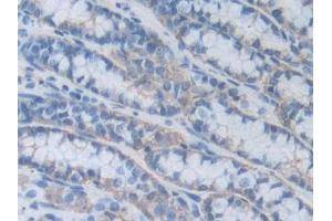 IHC-P analysis of Mouse Small intestine Tissue, with DAB staining. (HPSE antibody  (AA 353-464))