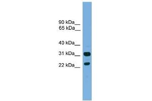 WB Suggested Anti-CD8B Antibody Titration:  0. (CD8B antibody  (Middle Region))