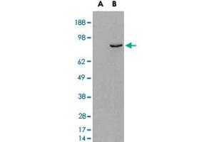 HEK293 overexpressing human PDE4B and probed with PDE4B polyclonal antibody  (mock transfection in first lane), tested by Origene. (PDE4B antibody)