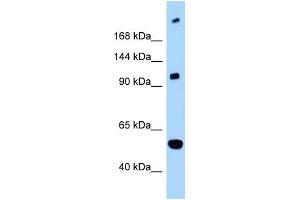 WB Suggested Anti-L1CAM Antibody Titration: 1. (L1CAM antibody  (C-Term))