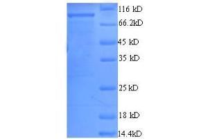 SDS-PAGE (SDS) image for ATP-Dependent DNA Helicase Rep (AA 1-673), (full length) protein (GST tag) (ABIN1095485) (ATP-Dependent DNA Helicase Rep (AA 1-673), (full length) protein (GST tag))