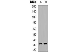 Western blot analysis of ACER2 expression in A549. (ACER2 antibody  (Center))