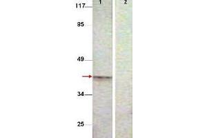 Western Blot shows detection of Aurora B protein at 39 kDa (predicted band size). (Aurora Kinase B antibody  (pThr232))