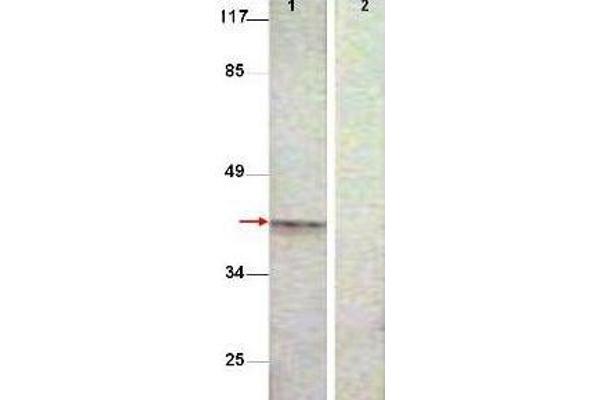 Aurora Kinase B antibody  (pThr232)