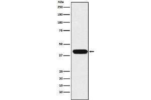 Western blot analysis of MATH1/HATH1 expression in HepG2 cell lysate.