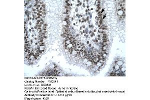 Immunohistochemistry with Human Intestine tissue (IRF8 antibody  (N-Term))