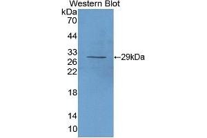 Western Blotting (WB) image for anti-Interleukin 2 Receptor, alpha (IL2RA) (AA 22-243) antibody (ABIN1862763) (CD25 antibody  (AA 22-243))
