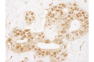 Immunohistochemistry (IHC) image for anti-TP53 induced glycolysis regulatory phosphatase (TIGAR) (AA 220-270) antibody (ABIN7448835) (TIGAR antibody  (AA 220-270))