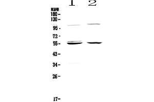 Western blot analysis of Caspase 8 using anti-Caspase 8 antibody . (Caspase 8 antibody  (AA 389-479))