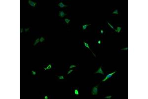 Immunofluorescence staining of SH-SY5Y cells with ABIN7161274 at 1:100, counter-stained with DAPI. (NEFH antibody  (AA 825-1003))