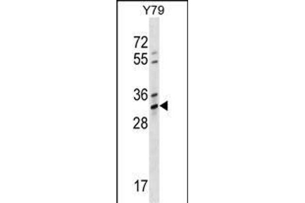 OR4K1 antibody  (N-Term)