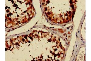 Immunohistochemistry of paraffin-embedded human testis tissue using ABIN7173663 at dilution of 1:100 (TUBA3C antibody  (AA 161-418))