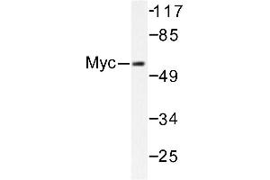 Image no. 1 for anti-Myc Proto-Oncogene protein (MYC) antibody (ABIN271739) (c-MYC antibody)