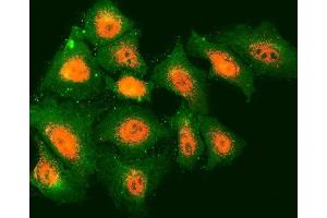 IF analysis of TMOD2 and Tubulin beta using anti-TMOD2 antibody (ABIN7599739) and anti-Tubulin beta antibody (ABIN7602744). (TMOD2 antibody  (AA 111-343))
