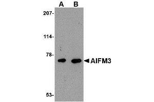 Western blot analysis of AIFM3 in human brain tissue lysate with AIFM3 antibody at (A) 1 and (B) 2 µg/ml. (AIFM3 antibody  (Center))