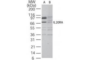 Western blot analysis of IL20RA in A-375 cell lysate in the (A) absence and (B) presence of blocking peptide using IL20RA polyclonal antibody  at 2 ug/mL . (IL20RA antibody  (AA 159-175))