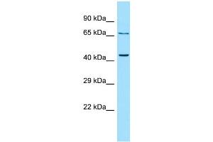 WB Suggested Anti-PTH2R Antibody Titration: 1.