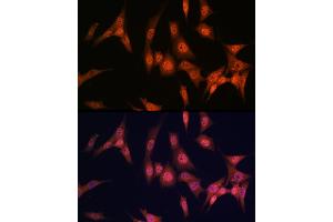 Immunofluorescence analysis of NIH/3T3 cells using P antibody (ABIN7269146) at dilution of 1:100. (PAK2 antibody)