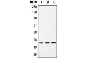 Western blot analysis of CD9 expression in HepG2 (A), SP2/0 (B), H9C2 (C) whole cell lysates. (CD9 antibody  (Center))