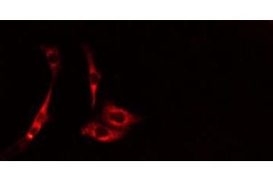 ABIN6274616 staining HepG2 cells by IF/ICC. (CDCA3 antibody  (C-Term))