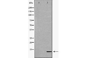 Western blot analysis of extracts of mouse kidney, using CYCS antibody. (Cytochrome C antibody  (N-Term))