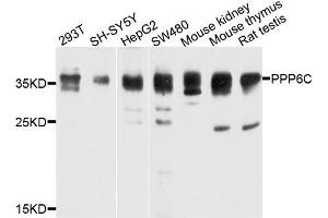Western blot analysis of extracts of various cells, using PPP6C antibody. (PPP6C antibody)