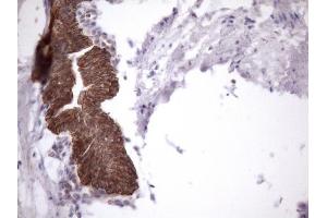 Immunohistochemistry (IHC) image for anti-Amelotin (AMTN) antibody (ABIN2716038)