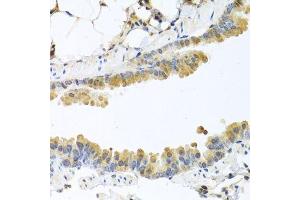 Immunohistochemistry of paraffin-embedded mouse lung using CPA1 antibody. (CPA1 antibody)