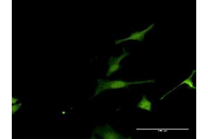 Immunofluorescence of purified MaxPab antibody to FAM117A on HeLa cell. (FAM117A antibody  (AA 1-453))