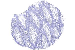 Colon descendes mucosa UPK1b immunostaining is absent in all cells of the colon mucosa (Uroplakin 1B antibody  (AA 109-229))