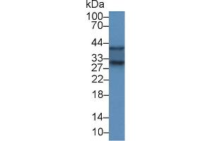 Detection of SOD3 in Rat Kidney lysate using Polyclonal Antibody to Superoxide Dismutase 3, Extracellular (SOD3) (SOD3 antibody  (AA 16-244))