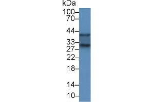 Detection of SOD3 in Rat Kidney lysate using Polyclonal Antibody to Superoxide Dismutase 3, Extracellular (SOD3) (SOD3 antibody  (AA 16-244))