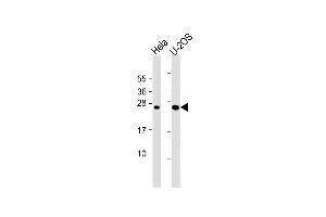 All lanes : Anti-DCTN6 Antibody (Center) at 1:1000 dilution Lane 1: Hela whole cell lysate Lane 2: U-2OS whole cell lysate Lysates/proteins at 20 μg per lane. (DCTN6 antibody  (AA 53-80))