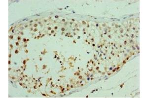 Immunohistochemistry of paraffin-embedded human testis tissue using ABIN7167040 at dilution of 1:100 (RDM1 antibody  (AA 125-284))