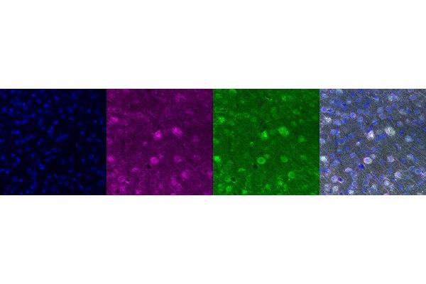 SSTR1 antibody