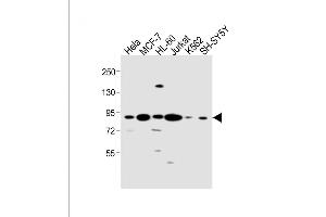 All lanes : Anti-CCNT1 Antibody (Center) at 1:1000 dilution Lane 1: Hela whole cell lysate Lane 2: MCF-7 whole cell lysate Lane 3: HL-60 whole cell lysate Lane 4: Jurkat whole cell lysate Lane 5: K562 whole cell lysate Lane 6: SH-SY5Y whole cell lysate Lysates/proteins at 20 μg per lane. (Cyclin T1 antibody  (AA 253-281))
