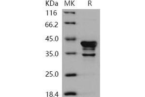 Western Blotting (WB) image for Calcium/calmodulin-Dependent Protein Kinase I (CAMK1) protein (ABIN7317143) (CAMK1 Protein)