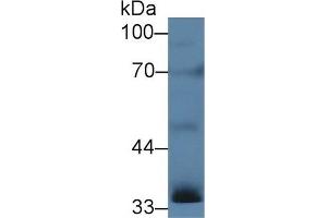 Detection of INHa in Rat Testis lysate using Polyclonal Antibody to Inhibin Alpha (INHa) (Inhibin alpha antibody  (AA 25-363))