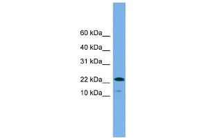 WB Suggested Anti-WFDC1 Antibody Titration: 0. (WFDC1 antibody  (N-Term))